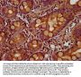 ZIC5 Antibody