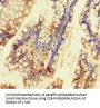 KCNK16 Antibody