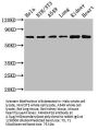ARHGAP18 Antibody