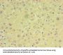 CHCHD4 Antibody