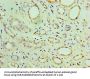 CHCHD4 Antibody
