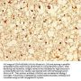 ZIC4 Antibody