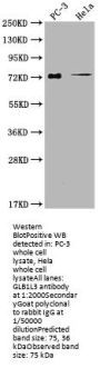 GLB1L3 Antibody
