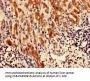 CFAP61 Antibody