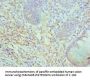 SMARCC2 Antibody
