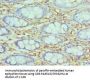 SMARCC2 Antibody