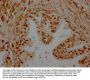 SMARCC2 Antibody