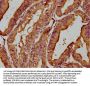 MICAL1 Antibody