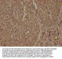 PPP1R13L Antibody