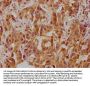 CELSR3 Antibody
