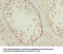 PIK3R3 Antibody