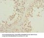 PIK3R3 Antibody