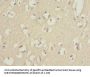 PIK3R3 Antibody