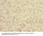 SLC25A36 Antibody