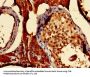 S100A16 Antibody
