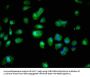 S100A16 Antibody