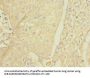 FCRL2 Antibody