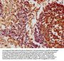 FCRL3 Antibody