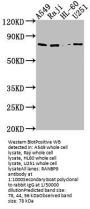 RANBP9 Antibody