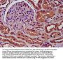 SLC34A3 Antibody