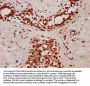 SMC1B Antibody