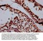 SMC1B Antibody