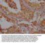 OR52B6 Antibody