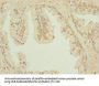 IL31RA Antibody