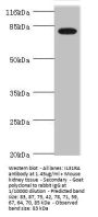 IL31RA Antibody