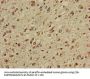 CPT1C Antibody