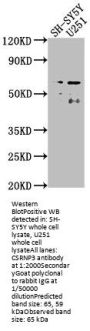 CSRNP3 Antibody