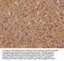 MYO18A Antibody