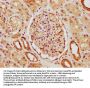 SLCO2A1 Antibody