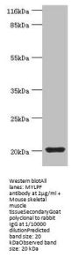 MYLPF Antibody