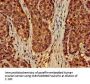 EFHD2 Antibody