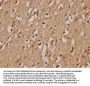 RHBDF1 Antibody