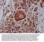 MTBP Antibody
