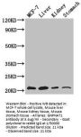 GNPNAT1 Antibody