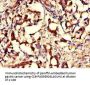 GNPNAT1 Antibody