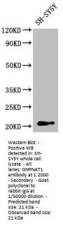GNPNAT1 Antibody