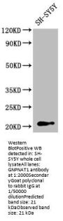 GNPNAT1 Antibody