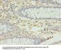 RMND5B Antibody