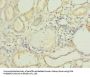 PLEKHA8 Antibody