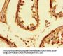 PRMT6 Antibody