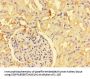 PRMT6 Antibody