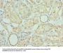 PRMT6 Antibody