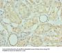 PRMT6 Antibody