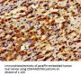 ADGRA2 Antibody