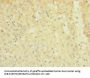 TRPM7 Antibody