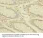 TRPM7 Antibody